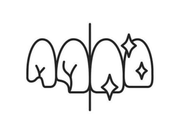 Cosmetic Dentistry